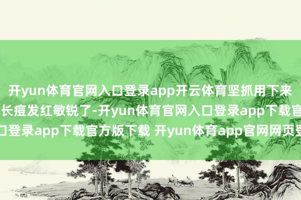 开yun体育官网入口登录app开云体育坚抓用下来我咫尺的头皮也不何如长痘发红敏锐了-开yun体育官网入口登录app下载官方版下载 开yun体育app官网网页登录入口