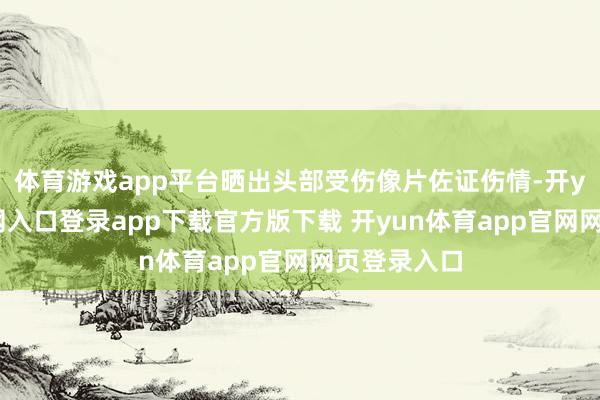 体育游戏app平台晒出头部受伤像片佐证伤情-开yun体育官网入口登录app下载官方版下载 开yun体育app官网网页登录入口